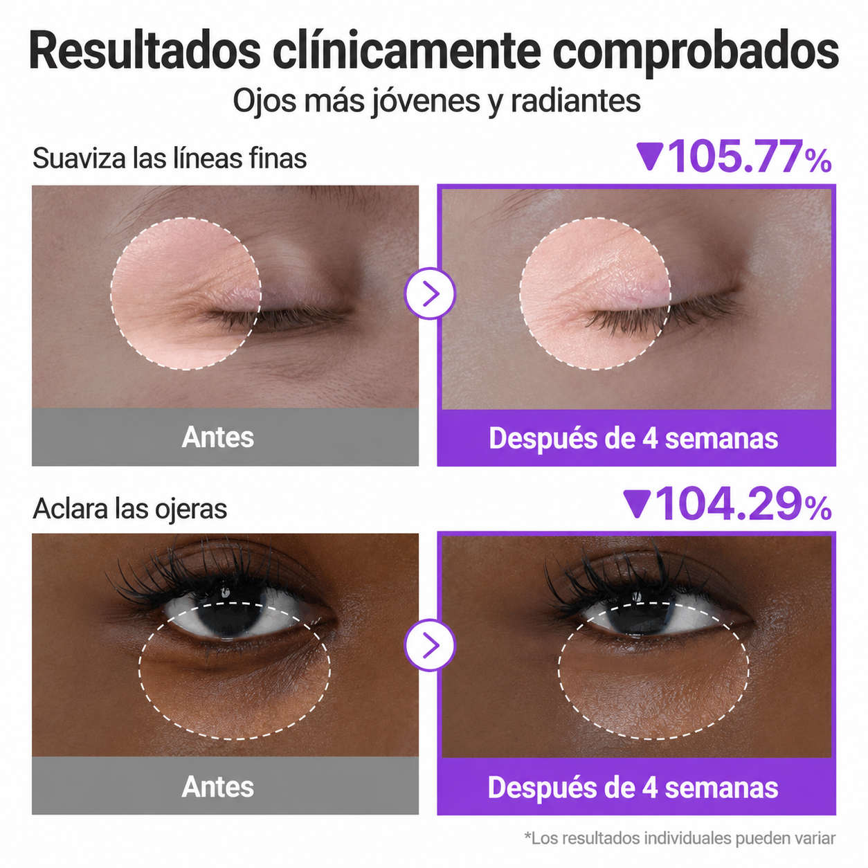 VT®-cosmetics Contorno de ojos 2 en 1