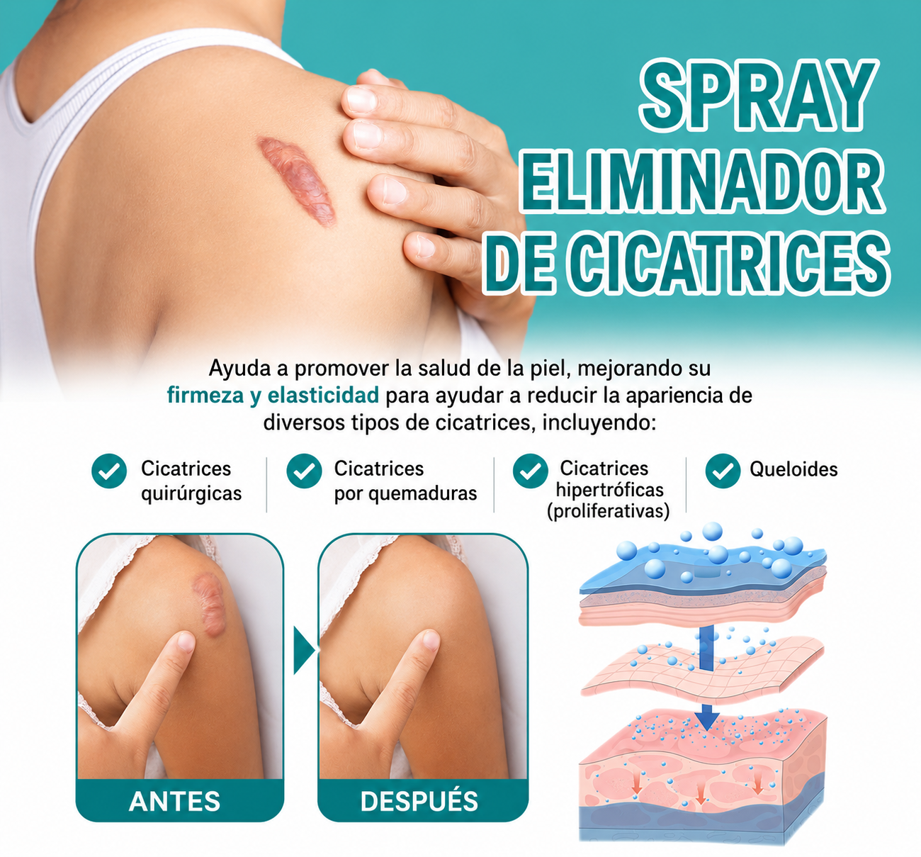 Paga 1 lleva 2 Medical Grade-Eliminación de cicatrices, Spray de grado médico