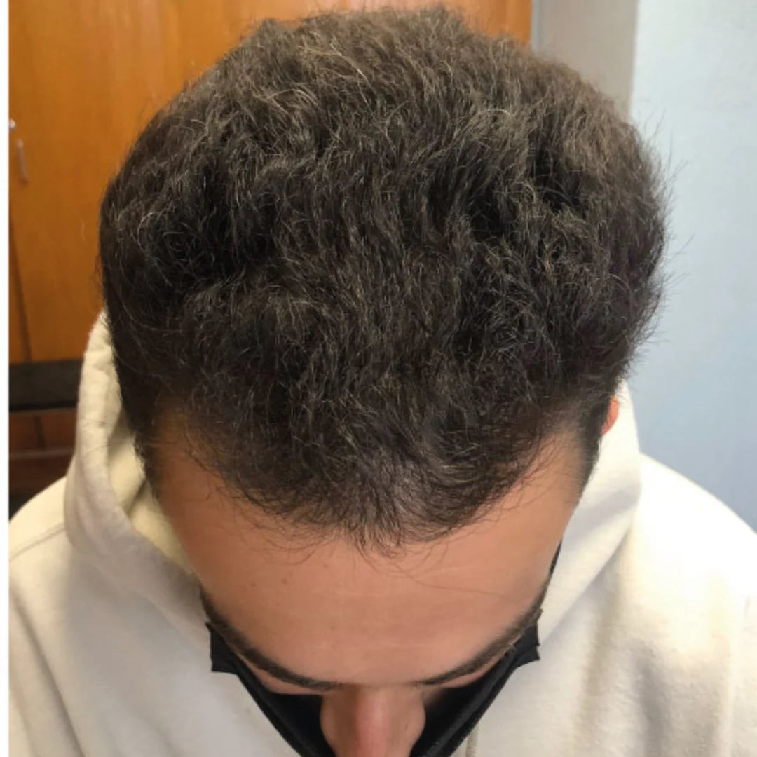 Tónico Ouhoe + Shampoo + Acondicionador SUPER COMBO PROMOCION!!